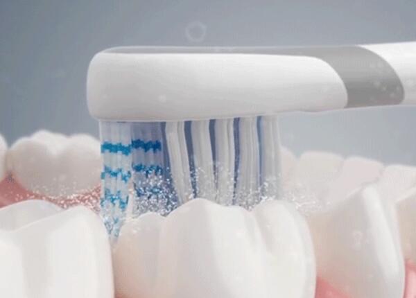 電動牙刷刷牙好嗎？真的比手動牙刷更好嗎？