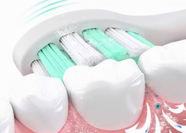 電動牙刷有什么用 電動牙刷有什么用